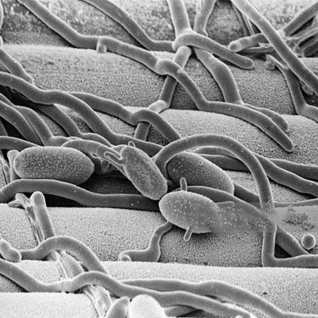 How to get rid of Mildew on a Hammock? - Simply Hammocks